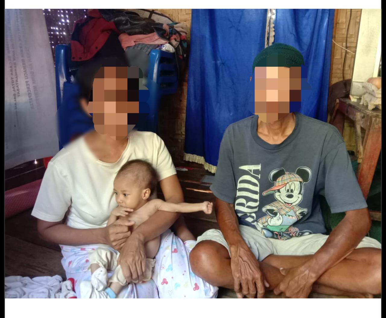 Lahir Dari Keluarga Kurang Mampu, Seorang Bayi di Buton Tengah Derita Gizi Buruk